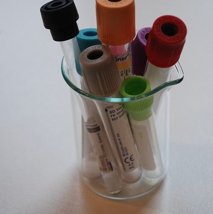 Clozapine Blood Work&nbsp;Change